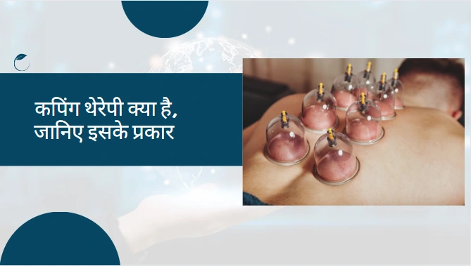 Cupping therapy kya hai ?